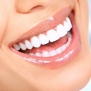Smile — Dental Services in East Maitland NSW