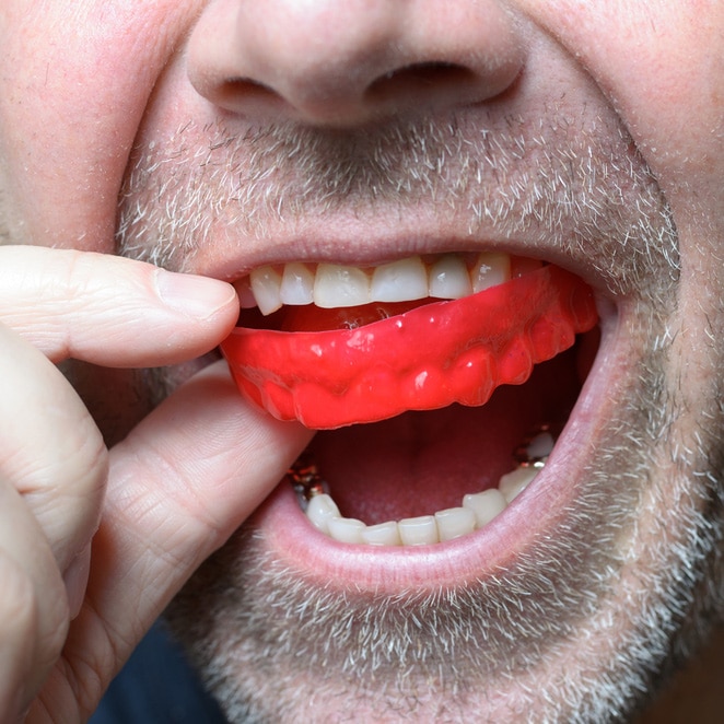 Man Placing a Red Bite Plate in His Mouth — Denture Clinic in Maitland, NSW